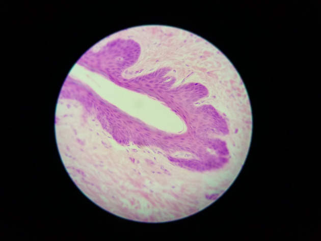 Stratified Squamous Epithelium Slides - Stratified Squamous Epithelium 02 400X